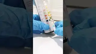 urine reagent strips 