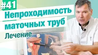 Непроходимость маточных труб. Лечение. В каких случаях возможно? Лапароскопия. Лапаротомия. ЭКО