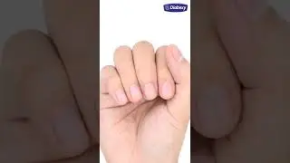 डायबिटीज में नाखूनों में इंफेक्शन क्यों होता है | Diabexy