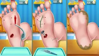 ASMR | Mencabut P4ku Yang Tertancap Pada Kaki