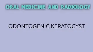 ODONTOGENIC KERATOCYST :- ORAL MEDICINE & RADIOLOGY by Dr.karthik A