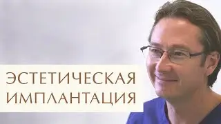 😊 Этапы и виды имплантации передних зубов. Этапы имплантации зубов. 12+