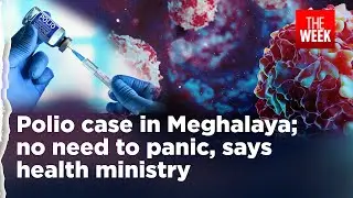 Polio case in two-year-old child in Meghalaya triggers debate on oral versus injectable vaccine