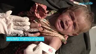 Donate to fight malnutrition crisis