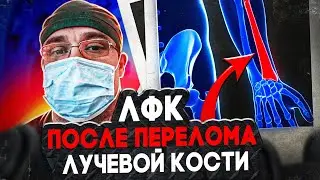 ЛФК после Перелома Лучевой Кости | Доктор Юршин