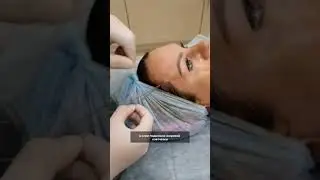 Коррекция нитями APTOS бровей