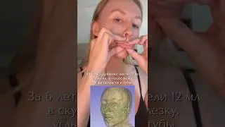 Как на самом деле выглядят филлеры?