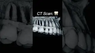 Your TEETH have DEEP ROOTS!! 🦷🌱