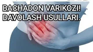 Bachadon Varikozi.Davolash usullari.