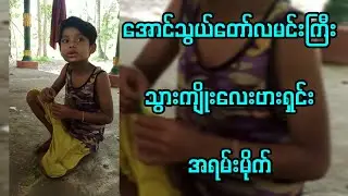အောင်သွယ်တော်လမင်းကြီး သွားကျိုးလေးဗားရှင်း အရမ်းမိုက်