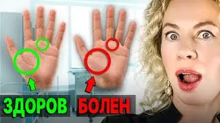 СЕКРЕТНЫЙ СПОСОБ! Как определить дефицит железа ПО РУКЕ?