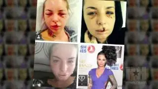 First Look at Christy Mack Since Vicious Assault - HipHollywood.com