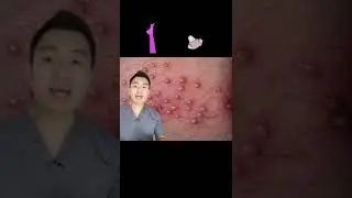 Sering jerawatan pada Miss V? 