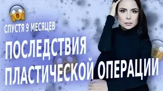 Пластическая операция. Последствия и осложнения. Пластическая хирургия. Увеличение груди.