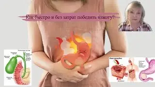 Простой способ избавиться от изжоги без усилий и затрат