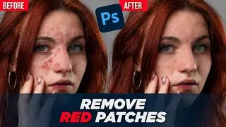 How to Remove Red Patches from Skin in Photoshop | Photo Retouching Trick