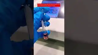 Cholesterol testing #bloodchemistry #laboratory #medtechstudent #cls #mls