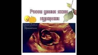 Скрининг МАЛУМОТ УЧУН ФАКАТ ТЕЛЕГРАМДАН ЁЗИНГ: +998950014004 #Узи #беременность #гинекология