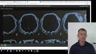 Как переслать исследования через интернет.