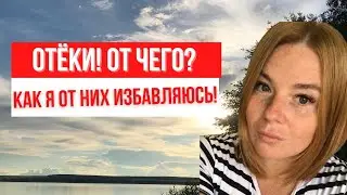 ОТЁКИ И ПОХУДЕНИЕ | КАК Я ИЗБАВИЛАСЬ ОТ ОТЁКОВ
