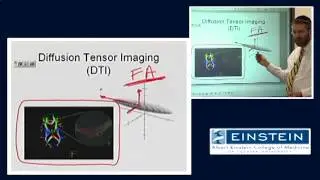 Introducing MRI: Diffusion Tensor Imaging (50 of 56)