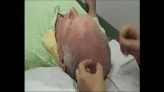 中风扎百会穴，具体定位和如何下针