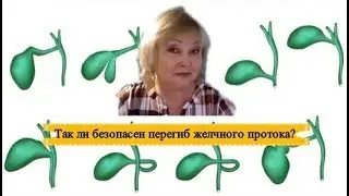 Перегиб  желчного протока, так ли безопасно?