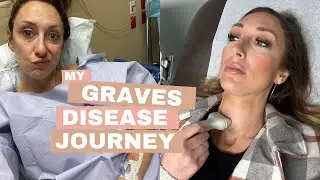 Part 2: Grave’s Disease/thyroid journey - Q&A with my Doctor, Josh Redd |  Jordan Page