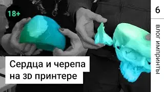 Сердце, череп и кости: 3D печать в медицине! 18+