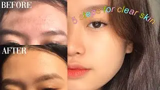 MY 5 BASIC STEPS FOR CLEAR SKIN 🍃✨ (Philippines)