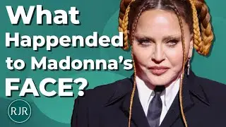 What Happened to Madonna’s Face!