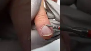 How to remove overgrown cuticles 