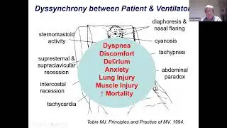 Ventilator Synchrony Issues