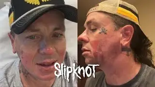 Slipknot's Sid Wilson Speaks Out After 'Face Melted' in Explosion