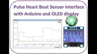 Heart Beat Sensor Interface with Arduino and OLED display
