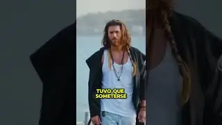 Conoce el misterio detrás de la enfermedad ocular de Can Yaman