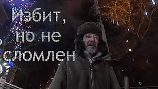 4 сезон 7 Серия (Избит, но не сломлен)