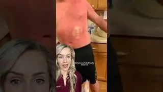Doctor reacts: extreme sunburn