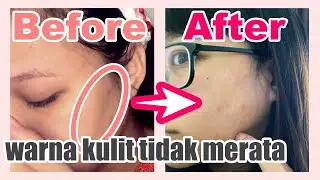 Kulit Hitam Tidak Merata Hilang Dalam 2 Minggu! Review Skin Care Paula's Choice