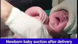 Baby suction after delivery