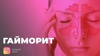 Прямой эфир: Гайморит и насморк