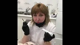 Карбокситерапия