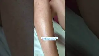 Гусиная кожа 😳  