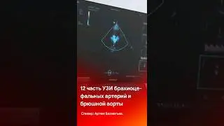 УЗИ брахиоцефальных артерий и брюшной аорты. 12 часть мастер-класса 