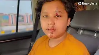 Irfan Haider k bete Nad e Ali ki car accident ke baad pehli video😭💔🙏