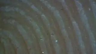 My Fingertip at 150x Magnification