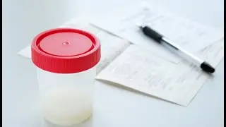 Procedura de Colectare a Spermei : Ghid Pas cu Pas