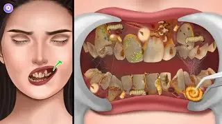 ASMR | Membersihkan Karang Gigi Yang Sangat Kotor