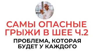 Самые опасные грыжи Шейный отдел позвоночника ч 2 | Реабилитолог Павел Артемьев