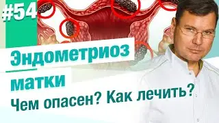 Что такое эндометриоз матки? Наружный и внутренний. Диагностика и симптомы эндометриоза